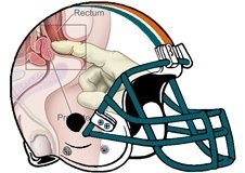 prostate-exam-fantasy-football-helmet